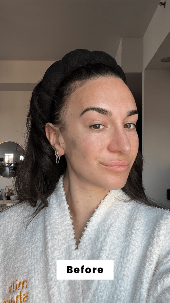 Wohlner before applying the Tom Fords Architecture Soft Matte Blurring Foundation